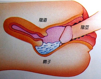 性交无快感